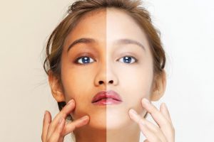 Change Dark Complexion into brighter skin