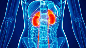 Get Rid of Kidney Disease