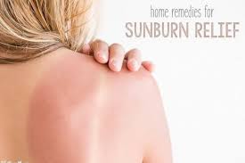 Sunburn Remedy